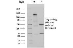 SDS-PAGE Analysis Purified IgM Recombinant Rabbit Monoclonal Antibody (IGHM/3135R). (Recombinant IGHM 抗体)