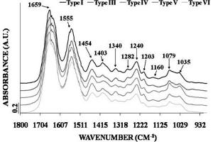 Fourier-transform infrared (FTIR) spectroscopy. (COL6 蛋白)