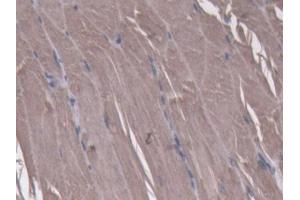 DAB staining on IHC-P; Samples: Mouse Skeletal muscle Tissue (NT5C 抗体  (AA 12-200))