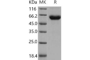 Western Blotting (WB) image for Activin A Receptor, Type IIB (ACVR2B) (Active) protein (His tag,Fc Tag) (ABIN7320386)