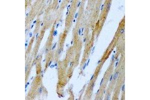 Immunohistochemical analysis of RRM2 staining in rat heart formalin fixed paraffin embedded tissue section. (RRM2 抗体)