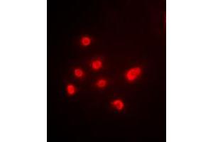 Immunofluorescent analysis of TBP staining in HEK293T cells. (TBP 抗体  (Center))