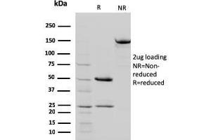 SDS-PAGE Analysis Purified STAT5B Mouse Monoclonal Antibody (STAT5B/2657). (STAT5B 抗体)