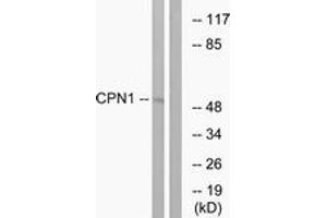 Western Blotting (WB) image for anti-Carboxypeptidase N Subunit 1 (CPN1) (AA 409-458) antibody (ABIN2890195) (CPN1 抗体  (AA 409-458))