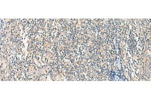 Immunohistochemistry of paraffin-embedded Human tonsil tissue using HASPIN Polyclonal Antibody at dilution of 1:45(x200) (GSG2 抗体)