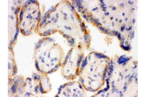 IHC analysis of Surfactant protein D using anti-Surfactant protein D antibody . (SFTPD 抗体  (C-Term))