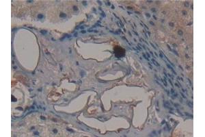 Detection of FMOD in Human Liver Tissue using Polyclonal Antibody to Fibromodulin (FMOD) (Fibromodulin 抗体  (AA 19-376))