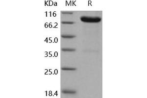 Western Blotting (WB) image for Interleukin 13 Receptor, alpha 2 (IL13RA2) (Active) protein (His tag,Fc Tag) (ABIN7196405) (IL13RA2 Protein (His tag,Fc Tag))