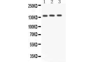 Anti- ACE antibody, Western blottingAll lanes: Anti ACE  at 0. (Angiotensin I Converting Enzyme 1 抗体  (N-Term))