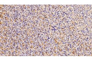 Immunohistochemistry (IHC) image for anti-Galectin 4 (LGALS4) (AA 1-323) antibody (ABIN7431569)