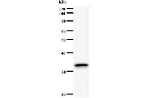 Western Blotting (WB) image for anti-PAP Associated Domain Containing 7 (PAPD7) antibody (ABIN931070) (PAP Associated Domain Containing 7 (PAPD7) 抗体)
