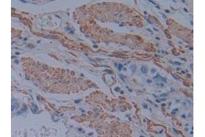 Immunohistochemistry (IHC) image for anti-Plastin 3 (PLS3) (AA 379-630) antibody (ABIN7436462)