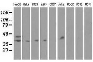 Image no. 2 for anti-Haptoglobin (HP) antibody (ABIN1498579) (Haptoglobin 抗体)