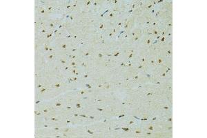 Immunohistochemistry of paraffin-embedded rat heart using RCC1 antibody. (RCC1 抗体  (AA 1-240))