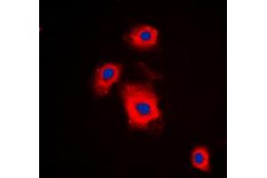 Immunofluorescent analysis of S6K1 (pS447) staining in A549 cells.