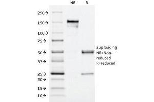 SDS-PAGE Analysis of Purified, BSA-Free MRP1 Antibody (clone MRP1/1344). (ABCC1 抗体)