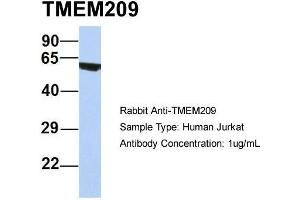 Host: Rabbit Target Name: TMEM209 Sample Type: Human Jurkat Antibody Dilution: 1. (TMEM209 抗体  (N-Term))