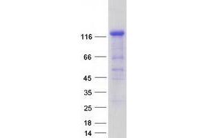 Validation with Western Blot (IB2 Protein (Transcript Variant 2) (Myc-DYKDDDDK Tag))