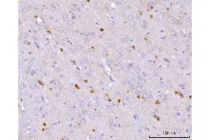IHC analysis of CAPON/NOS1AP using anti-CAPON/NOS1AP antibody (ABIN7600833). (NOS1AP 抗体  (AA 24-438))