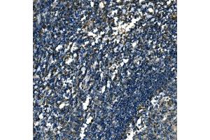 IHC analysis of ATP6V1A using anti-ATP6V1A antibody (ABIN7599916).