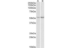 ABIN571236 (0. (Phenylalanine Hydroxylase 抗体  (Internal Region))