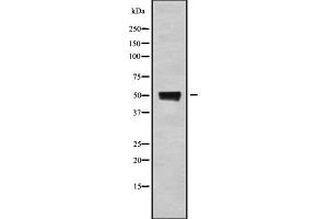 Western blot analysis of RXRgamma using HepG2 whole cell lysates (Retinoid X Receptor gamma 抗体  (Internal Region))