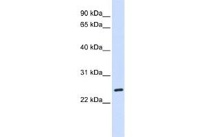 WB Suggested Anti-BAD Antibody Titration: 0. (BAD 抗体  (C-Term))