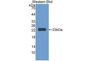 Western Blotting (WB) image for anti-CD47 (CD47) (AA 18-219) antibody (ABIN1859238)