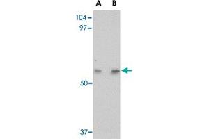 Western blot analysis of LGI4 in human brain tissue lysate with LGI4 polyclonal antibody  at (A) 1 and (B) 2 ug/mL . (LGI4 抗体  (Internal Region))