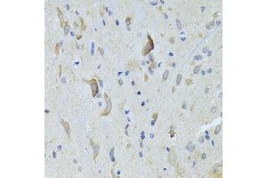 Immunohistochemistry of paraffin-embedded rat spinal cord using SARS Antibody. (Seryl-tRNA Synthetase (SARS) (AA 1-300) 抗体)
