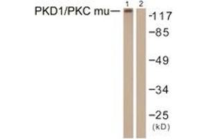 Western blot analysis of extracts from HepG2 cells, using PKD1/PKC mu (Ab-463) Antibody. (PKC mu 抗体  (AA 429-478))