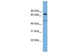 WB Suggested Anti-STIM1  Antibody Titration: 0. (STIM1 抗体  (Middle Region))