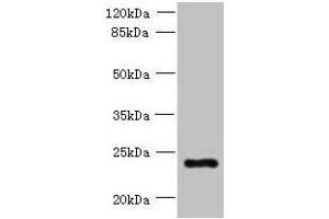 Western blot All lanes: PQLC3 antibody at 3 μg/mL + Mouse liver tissue Secondary Goat polyclonal to rabbit IgG at 1/10000 dilution Predicted band size: 23, 21 kDa Observed band size: 23 kDa (PQLC3 抗体  (AA 118-170))