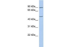 WB Suggested Anti-PLAG1 Antibody Titration:  0. (PLAG1 抗体  (C-Term))