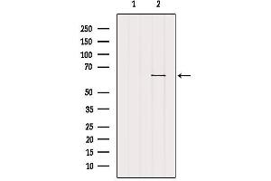 Western blot analysis of extracts from B16F10, using SLC22A6 Antibody. (SLC22A6 抗体  (C-Term))