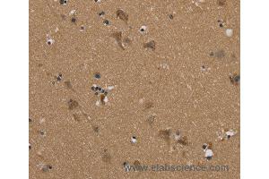 Immunohistochemistry of Human brain  using PUS10 Polyclonal Antibody at dilution of 1:45 (PUS10 抗体)