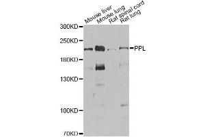 Western blot analysis of extracts of various cell lines, using PPL antibody. (PPL 抗体)