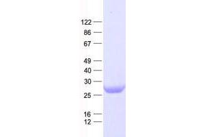 Western Blotting (WB) image for Chromosome 12 Open Reading Frame 44 (C12orf44) protein (His tag) (ABIN2715025)