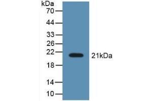 Detection of Recombinant LCN8, Mouse using Polyclonal Antibody to Lipocalin 8 (LCN8) (LCN8 抗体  (AA 27-176))