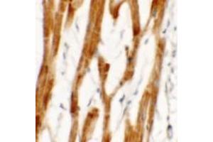Immunohistochemistry (IHC) image for anti-FCH Domain Only 2 (FCHO2) (Middle Region) antibody (ABIN1030931) (FCHO2 抗体  (Middle Region))
