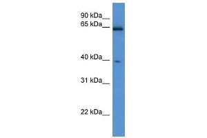 Western Blot showing Asrgl1 antibody used at a concentration of 1-2 ug/ml to detect its target protein. (ASRGL1 抗体  (C-Term))
