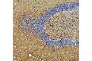 IHC analysis of Synapsin II using anti-Synapsin II antibody (ABIN4886735). (SYN2 抗体  (AA 497-582))