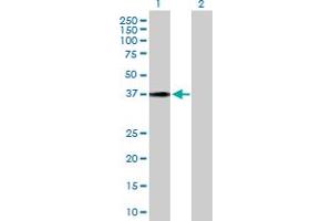 Western Blot analysis of HSD17B2 expression in transfected 293T cell line by HSD17B2 MaxPab polyclonal antibody. (HSD17B2 抗体  (AA 1-387))