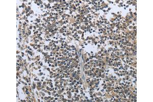 Immunohistochemistry (IHC) image for anti-Prolactin (PRL) antibody (ABIN2422068) (Prolactin 抗体)