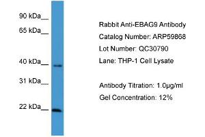 WB Suggested Anti-EBAG9  Antibody Titration: 0. (RCAS1 抗体  (C-Term))