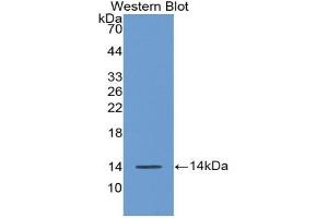Western blot analysis of the recombinant protein. (AGGF1 抗体  (AA 21-123))