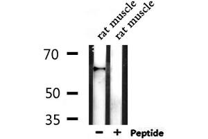 Western Blotting (WB) image for anti-Transcription Factor 7-Like 1 (T-Cell Specific, HMG-Box) (TCF7L1) (Internal Region) antibody (ABIN6258956)