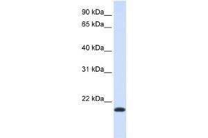 Western Blotting (WB) image for anti-Na+/K+ Transporting ATPase Interacting 1 (NKAIN1) (Middle Region) antibody (ABIN2783926)