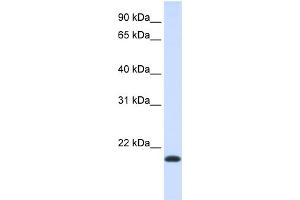 WB Suggested Anti-NKAIN1 Antibody Titration:  0. (NKAIN1 抗体  (Middle Region))
