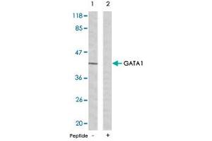 Western blot analysis of extracts from K-562 cells using GATA1 polyclonal antibody . (GATA1 抗体  (Ser142))